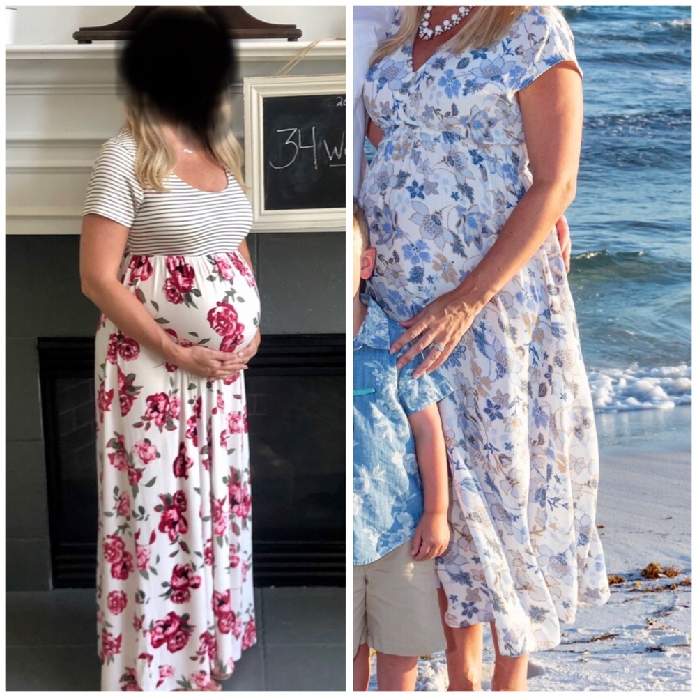 Gap & A. Glow Maternity Dresses